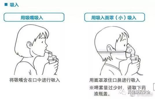 雾化后呛咳怎么办？全面解析应对措施